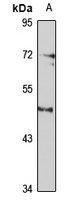 SSTR5 antibody