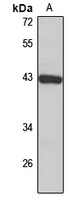 ST8SIA1 antibody