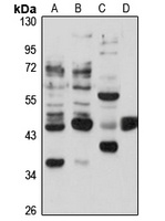 Anti-STAC Antibody