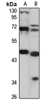 STK25 antibody