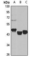 Anti-SUGCT Antibody
