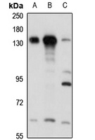 Anti-SFRS14 Antibody