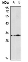 Anti-SULT1A2 Antibody