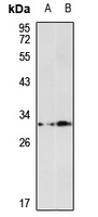 SULT1A2 antibody