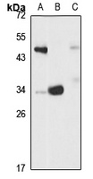 Anti-SULT1A3 Antibody
