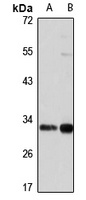 Anti-SUMF2 Antibody