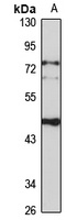 Anti-SUV39H1 Antibody