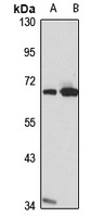 Anti-SWAP-70 Antibody