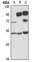 Anti-SYT13 Antibody