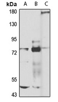 TAB2 antibody