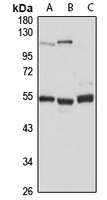 Anti-TADA3L Antibody