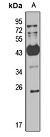 Anti-TAF11 Antibody