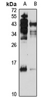 TAF12 antibody