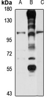Anti-GPR70 Antibody