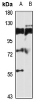 Anti-TBC1D15 Antibody