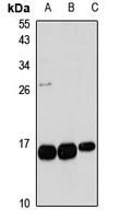 Anti-TBCA Antibody