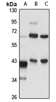 Anti-TBCC Antibody