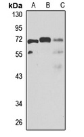 TBL1XR1 antibody