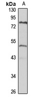 Anti-TBRG1 Antibody