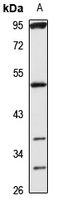 TBX19 antibody