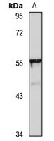 Anti-TBX20 Antibody