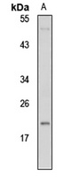 Anti-POD-1 Antibody