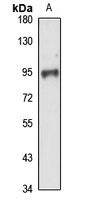 Anti-TCF25 Antibody