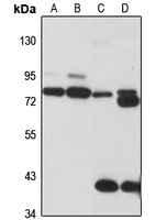 Anti-TCIRG1 Antibody