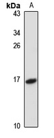 Anti-TCL-1B Antibody