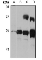 Anti-TDO2 Antibody