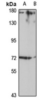 Anti-TDP1 Antibody