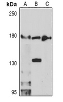 Anti-TET3 Antibody