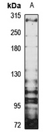 Thyroglobulin antibody