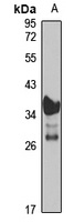 Transglutaminase 4 antibody