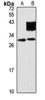 Anti-THAP3 Antibody