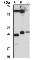 Anti-CTMP Antibody