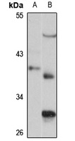 Anti-THOC3 Antibody