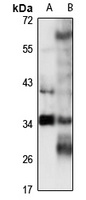 THOC6 antibody