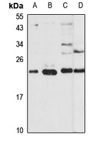 Anti-THOC7 Antibody