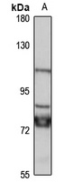 Anti-THSD4 Antibody