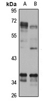 Anti-TRAM Antibody