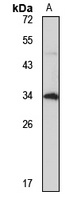 Anti-TIMMDC1 Antibody