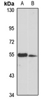 Anti-TINAGL1 Antibody
