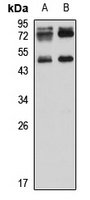 Anti-TIPIN Antibody