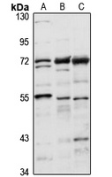 Anti-TKTL1 Antibody