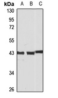 HOX11 antibody