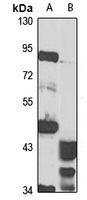 TM9SF3 antibody