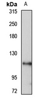 Anti-TMC5 Antibody
