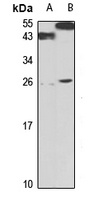 Anti-ST2L Antibody