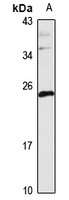 TMEM11 antibody